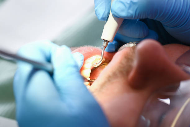 Trusted RI Emergency Dentist Experts